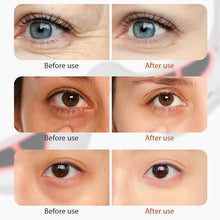 Load image into Gallery viewer, Optika Red Light Radiance Eye Massager